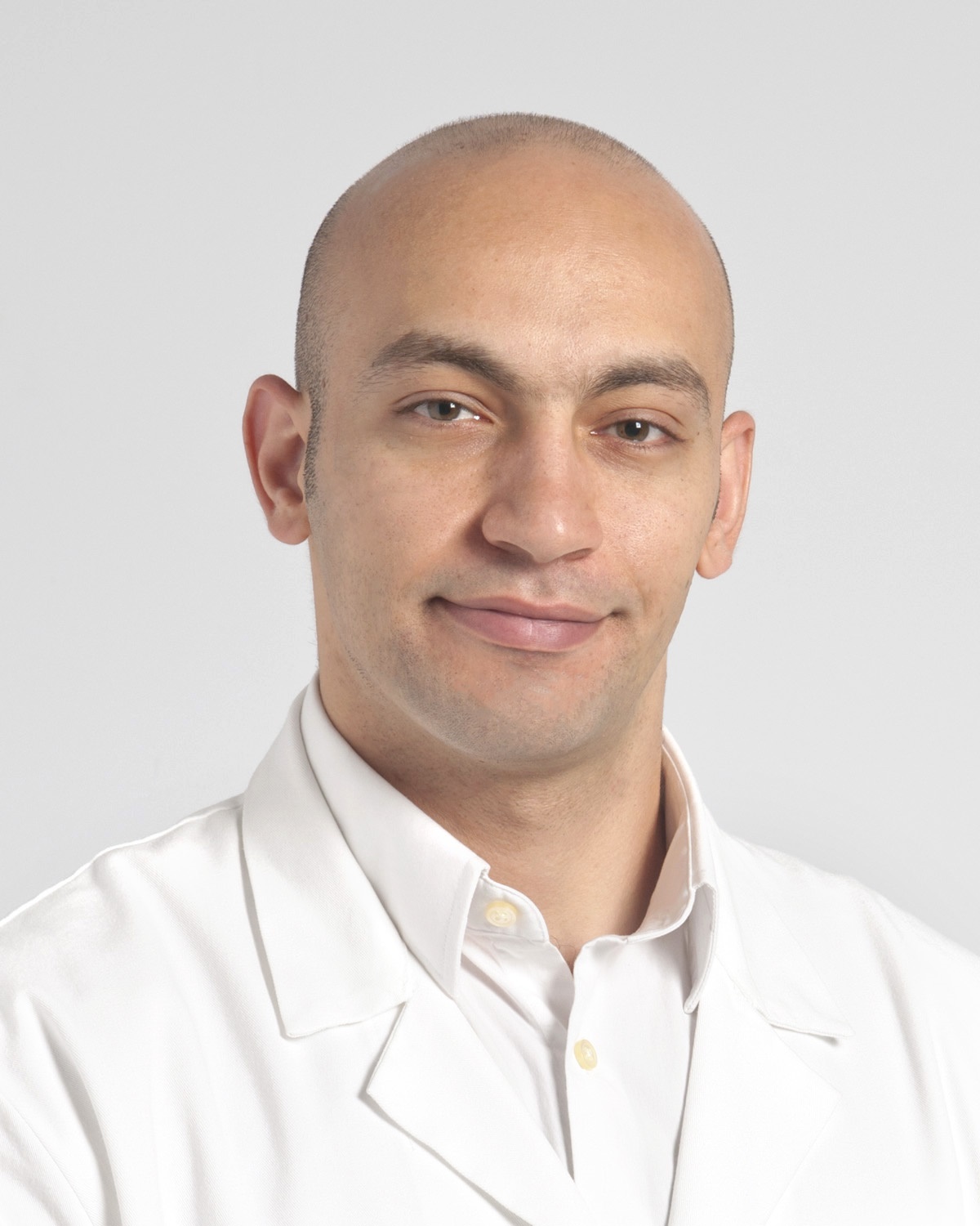 Reoperation for a detached left coronary button from an aortic root